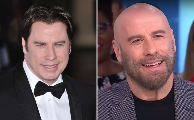 John Travolta Hair Evolution Benefits And Styling Solutions